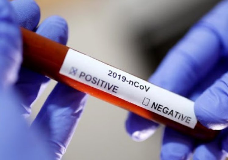 Coronavirus: Dio negativo el niño de Villa Trinidad y hay dos casos en Marull