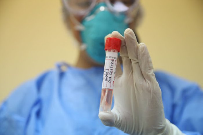 Dio negativo de coronavirus la mujer fallecida en Morteros