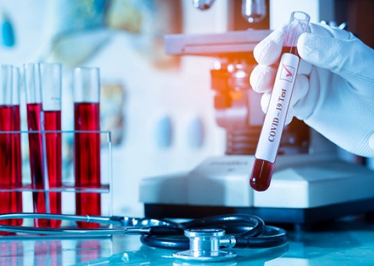 Coronavirus: Santa Fe reportó 889 casos