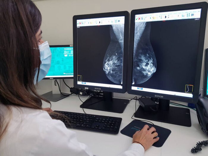 Ponen en funcionamiento un mamógrafo en el SAMCO de San Guillermo