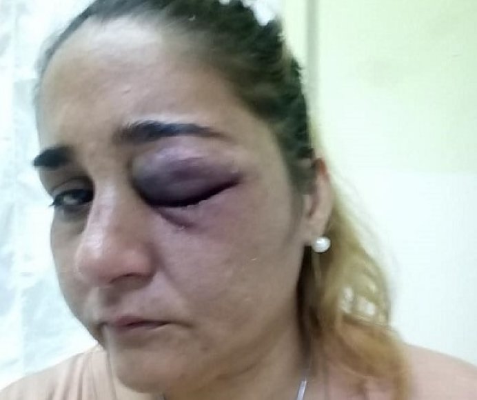 Mujer de Morteros brutalmente golpeada por su ex pareja