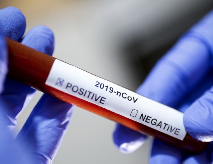 Brinkmann informó sobre otros 25 casos de covid 19