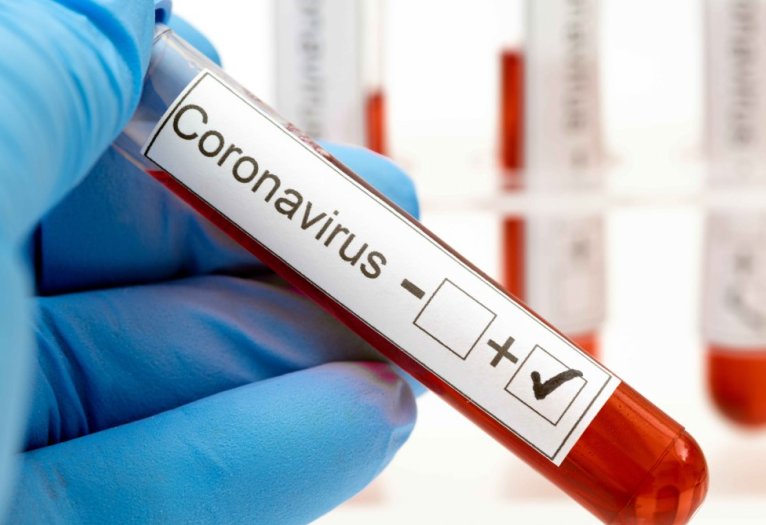 Vuelven a subir los casos activos en Suardi