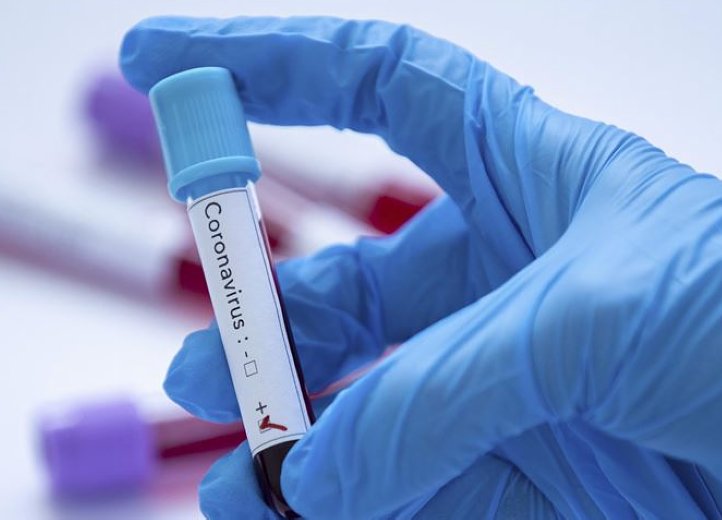 El panorama epidemiológico en localidades de la región