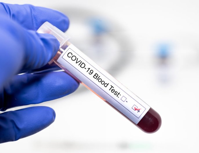 Domingo por debajo de los 1000 casos en la provincia