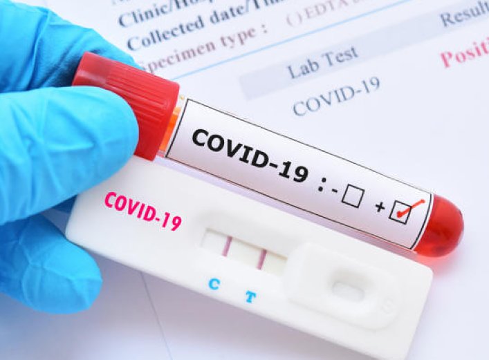 La semana cierra con otros 4 casos de covid en Suardi