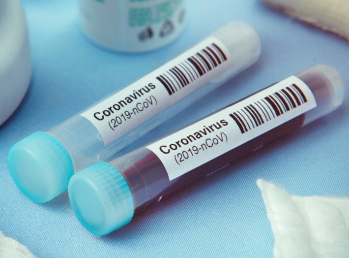 Domingo con más de 1800 casos en la provincia