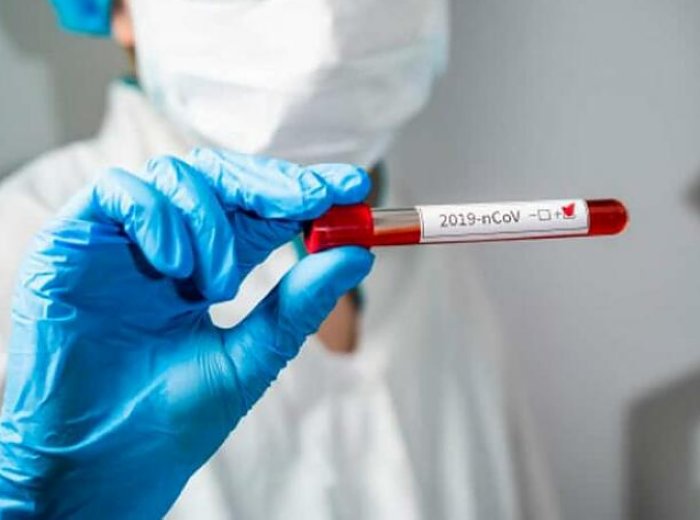 Subieron los casos de coronavirus en San Guillermo