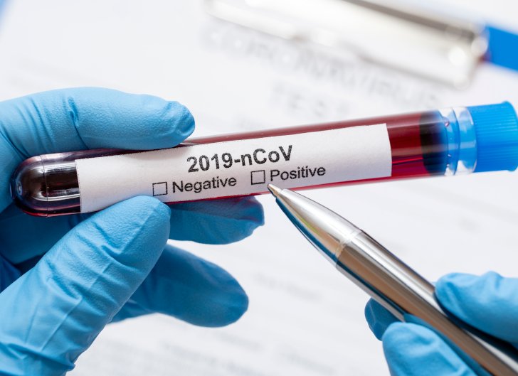 Coronavirus: La provincia reportó menos de 400 casos
