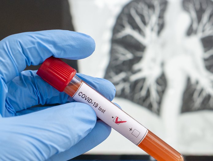 Suardi sigue libre de coronavirus
