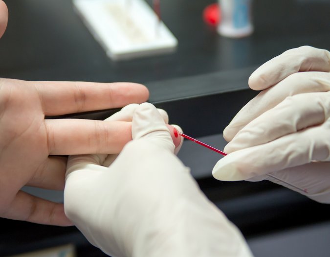 La provincia presentó la red de testeos rápidos de VIH