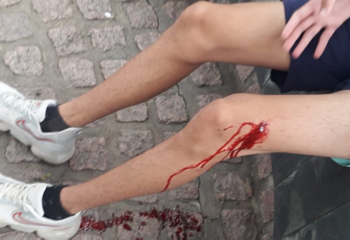 Morteros: Grupo de jóvenes hirieron a otro con un arma blanca